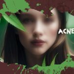 Woman Face acne cannabis